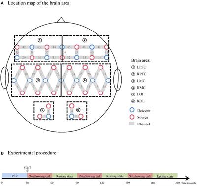 Hemodynamic signal changes and swallowing improvement of repetitive transcranial magnetic stimulation on stroke patients with dysphagia: A randomized controlled study